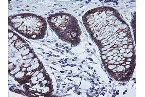 Immunohistochemical staining of paraffin-embedded Human colon tissue using anti-CAST mouse monoclonal antibody. (Calpastatin antibody)