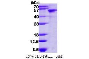 SDS-PAGE (SDS) image for Keratin 14 (KRT14) (AA 1-472) protein (His tag) (ABIN667956) (KRT14 Protein (AA 1-472) (His tag))