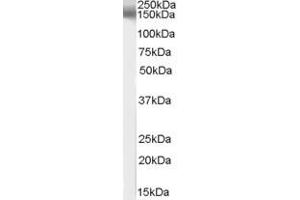 ABIN185520 (1µg/ml) staining of human brain lysate (35µg protein in RIPA buffer). (EPB41L3 antibody  (C-Term))