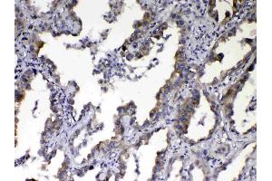 IHC analysis of NOV/CCN3 using anti-NOV/CCN3 antibody . (NOV antibody  (C-Term))