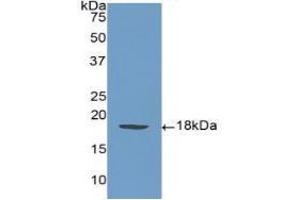 Detection of Recombinant SELP, Human using Polyclonal Antibody to P-Selectin (SELP) (P-Selectin antibody  (AA 58-195))