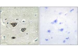 Immunohistochemistry analysis of paraffin-embedded human brain tissue, using CDH8 Antibody. (Cadherin 8 antibody  (AA 491-540))