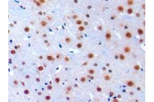Detection of IRF1 in Mouse Cerebrum Tissue using Polyclonal Antibody to Interferon Regulatory Factor 1 (IRF1) (IRF1 antibody  (AA 44-319))