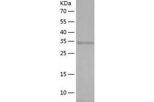 Western Blotting (WB) image for Uracil phosphoribosyltransferase (FUR1) Homolog (UPRT) (AA 1-309) protein (His tag) (ABIN7125658) (UPRT Protein (AA 1-309) (His tag))
