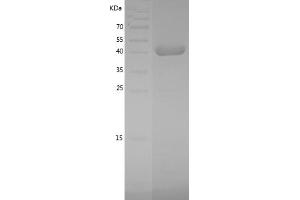 MAPK11 Protein (AA 1-364) (His tag)