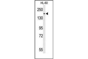 Western blot analysis of PLCB1 Antibody (C-term) in HL-60 cell line lysates (35ug/lane). (Phospholipase C beta 1 antibody  (C-Term))