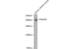 Western blot analysis of extracts of mouse skeletal muscle, using PDE4DIP antibody (ABIN6132801, ABIN6145357, ABIN6145358 and ABIN6223715) at 1:1000 dilution. (PDE4DIP antibody  (AA 1-310))