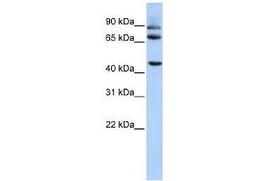 DPP10 antibody used at 1 ug/ml to detect target protein.