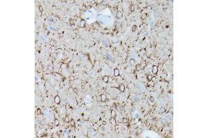 Immunohistochemistry of paraffin-embedded mouse brain using α-Tubulin Mouse mAb (ABIN7271035) at dilution of 1:100 (40x lens). (TUBA4A antibody)