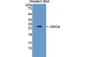 Western blot analysis of the recombinant protein. (CDNF antibody  (AA 20-183))
