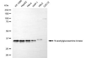 Western blotting analysis using N-acetylglucosamine kinase antibody (ABIN7799530). (NAGK antibody)