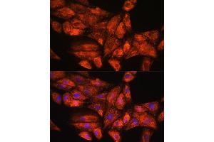 Immunofluorescence analysis of H9C2 cells using PPP1R15A Rabbit pAb (ABIN7269676) at dilution of 1:100. (GADD34 antibody  (AA 375-674))