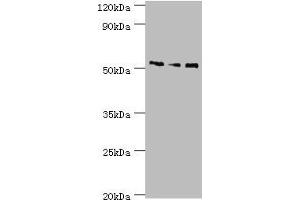 Western blot All lanes: Neuronal acetylcholine receptor subunit alpha-5 antibody at 12 μg/mL Lane 1: Jurkat whole cell lysate Lane 2: A431 whole cell lysate Lane 3: A549 whole cell lysate Secondary Goat polyclonal to rabbit IgG at 1/10000 dilution Predicted band size: 53 kDa Observed band size: 53 kDa (CHRNA5 antibody  (AA 23-240))