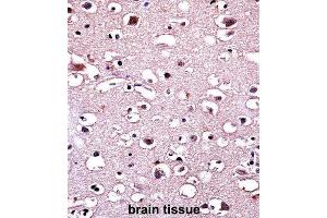 Immunohistochemistry (IHC) image for anti-Parkinson Protein 2, E3 Ubiquitin Protein Ligase (Parkin) (PARK2) antibody (ABIN3002635) (Parkin antibody)