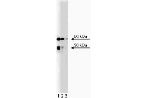 Western blot anakysis of Chk2 on RSV-3T3 lysate. (CHEK2 antibody  (AA 31-234))