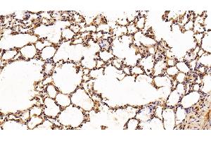 Detection of IL6 in Rat Lung Tissue using Polyclonal Antibody to Interleukin 6 (IL6) (IL-6 antibody  (AA 21-211))
