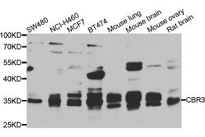 Western blot analysis of extracts of various cell lines, using CBR3 antibody (ABIN5975603) at 1/1000 dilution. (CBR3 antibody)
