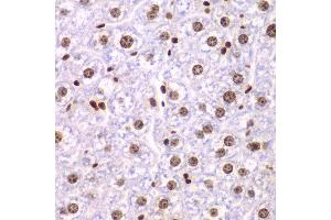 Immunohistochemistry of paraffin-embedded mouse liver using SSRP1 antibody at dilution of 1:200 (400x lens). (SSRP1 antibody)