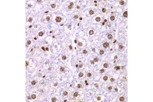 Immunohistochemistry of paraffin-embedded mouse liver using SSRP1 antibody at dilution of 1:200 (400x lens). (SSRP1 antibody)