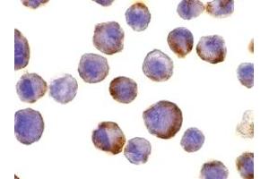 Immunohistochemistry (IHC) image for anti-ADAM Metallopeptidase Domain 17 (ADAM17) (C-Term) antibody (ABIN1030720) (ADAM17 antibody  (C-Term))