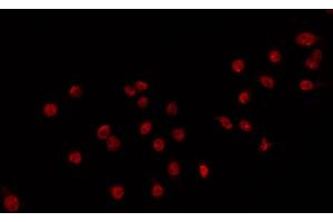 ABIN6266717 staining 293 by IF/ICC. (DLX3 antibody  (Internal Region))