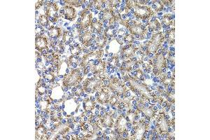 Immunohistochemistry of paraffin-embedded rat kidney using COPS2 antibody (ABIN6130123, ABIN6138877, ABIN6138878 and ABIN6222819) at dilution of 1:100 (40x lens). (COPS2 antibody  (AA 1-310))