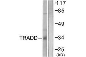 Western blot analysis of extracts from COS7 cells, using TRADD Antibody. (TRADD antibody  (AA 251-300))