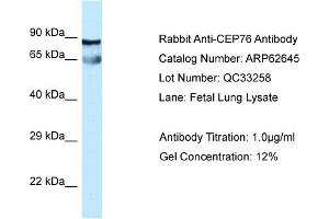 Western Blotting (WB) image for anti-Centrosomal Protein 76kDa (Cep76) (Middle Region) antibody (ABIN2789198) (Cep76 antibody  (Middle Region))