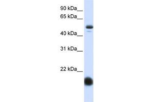WB Suggested Anti-SLC22A7 Antibody Titration:  0. (SLC22A7 antibody  (N-Term))