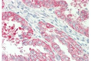 Rabbit Anti-HBEGF antibody Catalog Number: ARP45201 Formalin Fixed Paraffin Embedded Tissue: Human Uterus Primary antibody Concentration: 1:100 Secondary Antibody: Donkey anti-Rabbit-Cy3 Secondary Antibody Concentration: 1:200 Magnification: 20x Exposure Time: 0. (HBEGF antibody  (N-Term))