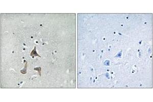 Immunohistochemistry analysis of paraffin-embedded human brain tissue, using RGR Antibody. (RGR antibody  (AA 169-218))