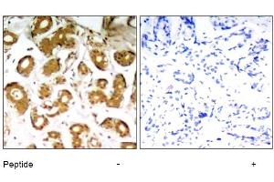 Image no. 1 for anti-Nuclear Factor-kB p65 (NFkBP65) (Thr505) antibody (ABIN319321)