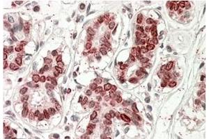 AP32140PU-N STS2 / TULA antibody staining of paraffin embedded Human Breast at 3. (UBASH3A antibody  (Internal Region))