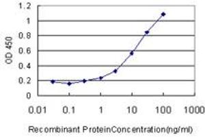 Detection limit for recombinant GST tagged CA12 is approximately 1ng/ml as a capture antibody. (CA12 antibody  (AA 25-124))