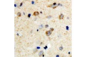 Immunohistochemical analysis of mPR gamma staining in human brain formalin fixed paraffin embedded tissue section. (PAQR5 antibody  (C-Term))