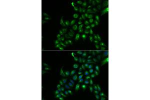 Immunofluorescence analysis of U2OS cells using TSPAN7 antibody (ABIN6291621). (Tetraspanin 7 antibody)