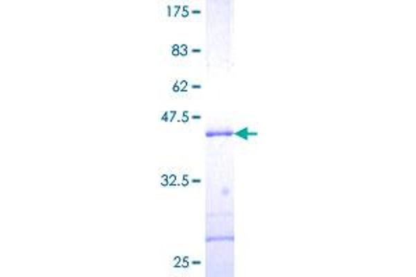 SUMO3 Protein (AA 1-103) (GST tag)