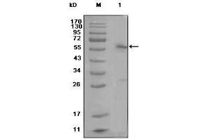 Western blot analysis using ESR1 mouse mAb against MCF-7 cell lysate (1) (Estrogen Receptor alpha antibody)