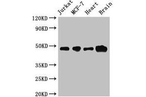 Western Blot Positive WB detected in: Jurkat whole cell lysate, MCF-7 whole cell lysate, Mouse heart tissue, Mouse brain tissue All lanes: ZNF645 antibody at 3. (ZNF645 antibody  (AA 200-413))