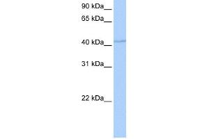 WB Suggested Anti-DPH1 Antibody Titration: 0. (DPH1 antibody  (Middle Region))