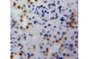 Used in DAB staining on fromalin fixed paraffin-embedded Kidney tissue (PPIE antibody  (AA 41-264))