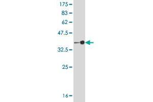 Western Blot detection against Immunogen (37 KDa) . (PCYT2 antibody  (AA 25-123))