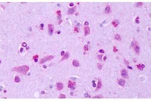 GPR75 antibody  (Extracellular Domain)