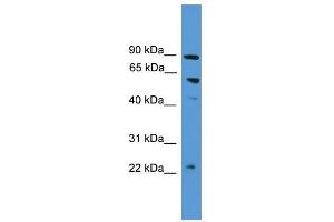 WB Suggested Anti-PDZK1  Antibody Titration: 0. (PDZK1 antibody  (N-Term))