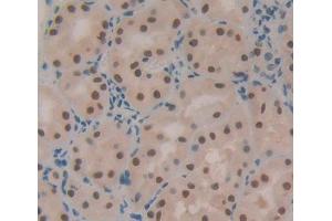 IHC-P analysis of Human Tissue, with DAB staining. (X-Ray Repair Cross Complementing 5 (AA 2-460) antibody)