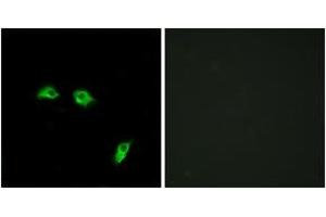 Immunofluorescence analysis of HeLa cells, using GABBR1 Antibody. (GABBR1 antibody  (AA 891-940))