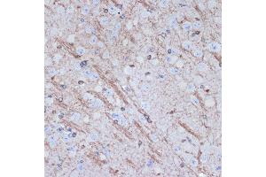 Immunohistochemistry of paraffin-embedded mouse brain using TMOD2 Rabbit mAb (ABIN7271011) at dilution of 1:100 (40x lens). (TMOD2 antibody)