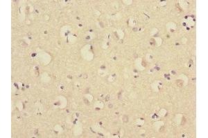 Immunohistochemistry of paraffin-embedded human brain tissue using ABIN7151282 at dilution of 1:100 (TRIM69 antibody  (AA 1-341))