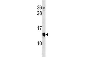 Cdkn2a antibody western blot analysis in mouse spleen tissue lysate. (CDKN2A antibody  (AA 39-65))