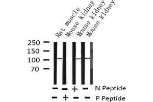 Western blot analysis of Phospho-PKD1/2/3/PKC μ (Ser738+Ser742) expression in various lysates (PKD1/2/3/PKC mu (pSer738), (pSer742) antibody)